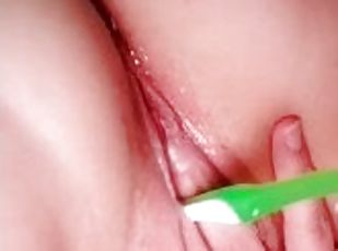 Toothbrush in urethra